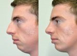 The Centre for Advanced Facial Cosmetic and Plastic Surgery: Dr Julian de Silva - 3